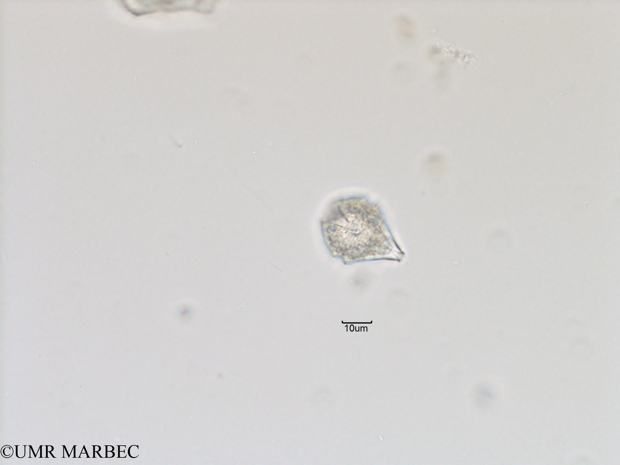 phyto/Bizerte/bizerte_bay/RISCO November 2015/Scrippsiella spinifera (ancien Scrippsiella spp-Baie_T5-ACW1-cf Scrippsiella-2).tif(copy).jpg